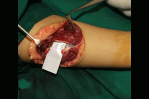 Clinical photograph, Hand Trauma & Fractures
