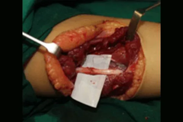 Clinical photograph, Hand Trauma & Fractures