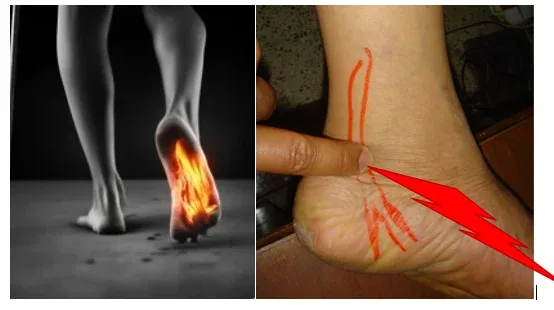Clinical photograph, Diabetic Foot & Nerve Decompression