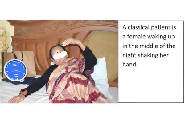Clinical photograph, Numbness & Tingling (Nerve Compression)