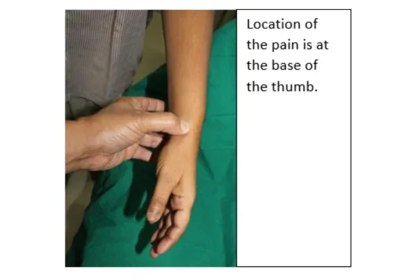 Clinical photograph, Hand & Wrist Pain and Arthritis