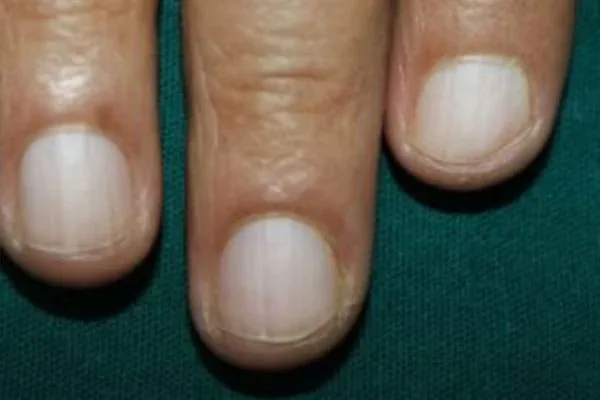 Clinical photograph, Hand & Wrist Pain and Arthritis