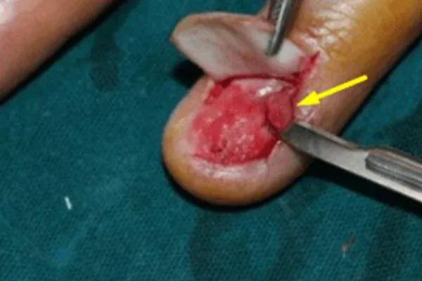Clinical photograph, Hand & Wrist Pain and Arthritis