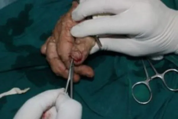 Clinical photograph, Hand & Wrist Pain and Arthritis