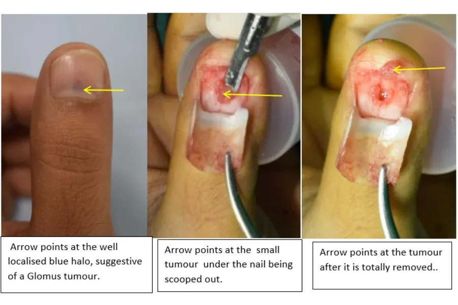 Clinical photograph, Hand & Wrist Pain and Arthritis