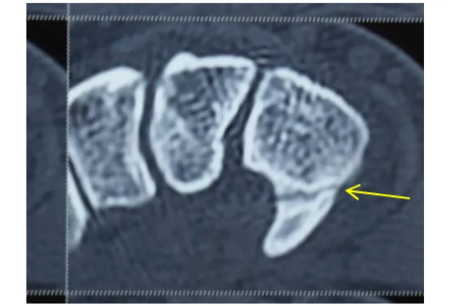 Clinical photograph, Hand & Wrist Pain and Arthritis