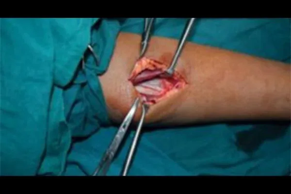 Clinical photograph, Hand & Wrist Pain and Arthritis