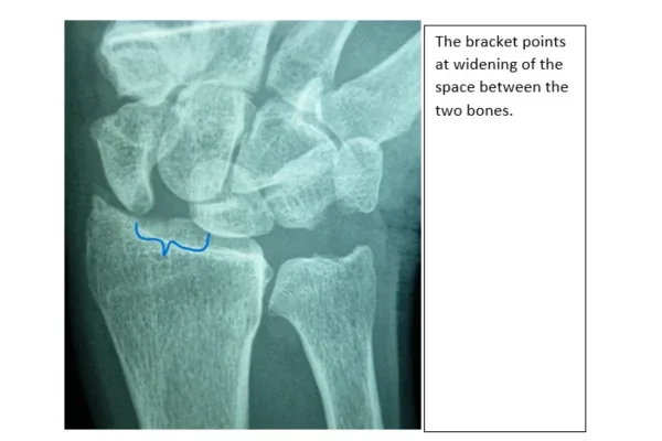 Clinical photograph, Hand & Wrist Pain and Arthritis