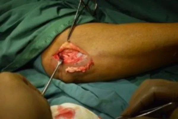 Clinical photograph, Hand & Wrist Pain and Arthritis