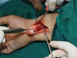 Clinical photograph, Hand Tumours & Swelling