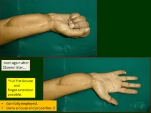 Clinical photograph, Reconstruction & Deformity Correction