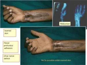 Clinical photograph, Reconstruction & Deformity Correction