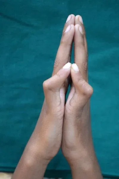 Clinical photograph, Congenital Hand Differences