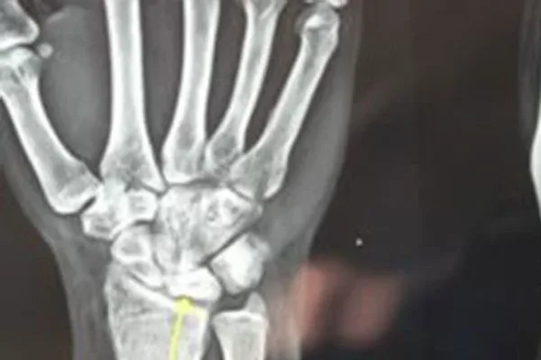 Clinical photograph, Congenital Hand Differences